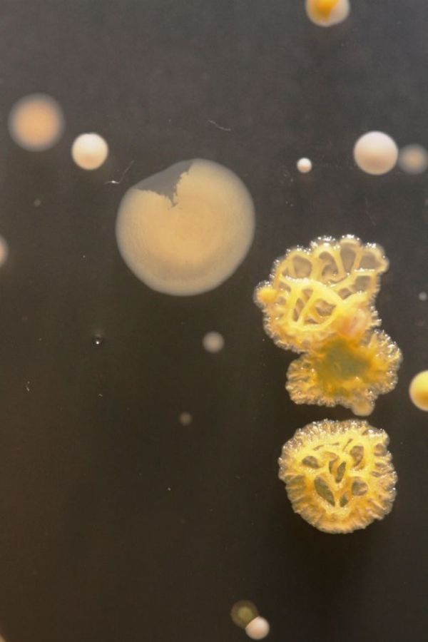 Pics: Your Phone Is a Bacteria Playground!
